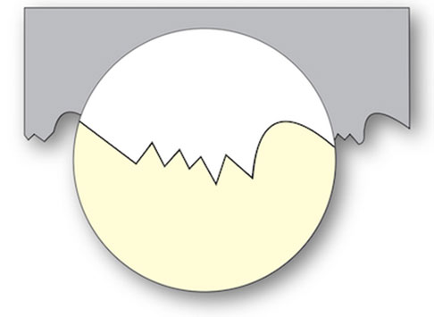 tooth breakage diagram